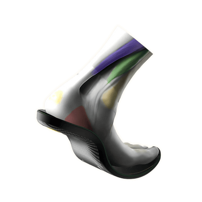 MVP Orthotics