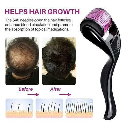 Titanium Dermal Roller for Hair Regrowth & Scalp Health